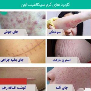 کرم ترمیم کننده اون 100 میل CICALFATE PLUS